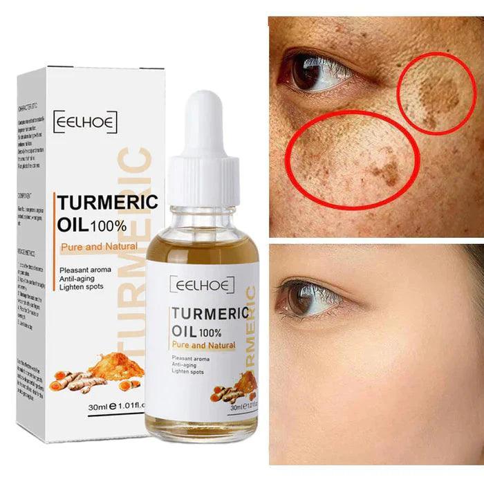 Turmeric™ Óleo Anti-Idade Removedor de Manchas (Até 33% De Desconto) - Loja Ofertazzi