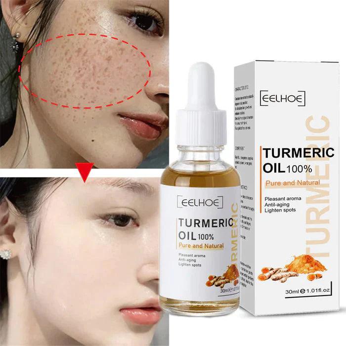 Turmeric™ Óleo Anti-Idade Removedor de Manchas (Até 33% De Desconto) - Loja Ofertazzi